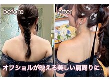 アミクール エステティックサロン(amicoeur)の雰囲気（【気になる部位を徹底ヤセ・ラフォス】ブライダルの方にも人気★）
