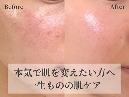 リンク(Link)の写真