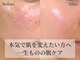 リンク(Link)の写真