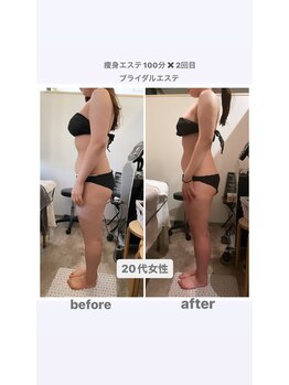 トランキーロ(Tranquilo)/ブライダルエステにおすすめ！