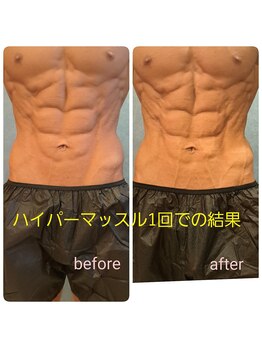 アンレーヴ/ハイパーマッスル