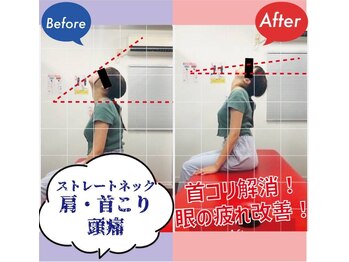 ナオル整体 西川口院(NAORU整体)/首のチェック♪　柔軟性up