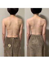 ホーム アイラッシュアンドボディ(Home)/巻き肩改善マッサージ