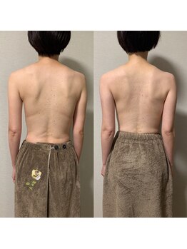 ホーム アイラッシュアンドボディ(Home)/巻き肩改善マッサージ