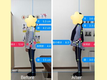 ナオル整体 春日部院(NAORU整体)/春日部/整体/骨盤矯正/猫背矯正