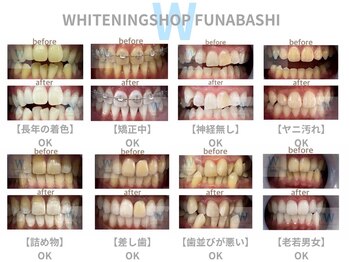 ホワイトニングショップ 船橋店