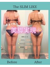 スリムライク 鳥取店(The SLIM LIKE)/痩身ビフォーアフター