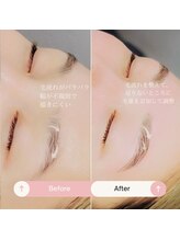 シャルトルズ/症例写真１