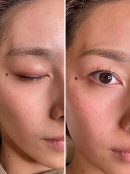 アウル(OWL)の写真/【多摩センター駅徒歩3分/アイブロウ専門店】全顔ワックス脱毛がおすすめ！鎮静保湿パック付き◎