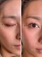 アウル(OWL)の写真/【多摩センター駅徒歩3分/アイブロウ専門店】全顔ワックス脱毛がおすすめ！鎮静保湿パック付き◎