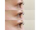 ラッシュベイビー(LASH Baby)の写真