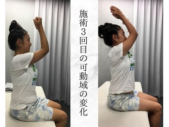 リバティ 世田谷代田整体院(Liberty)/肩甲骨はがしで肩甲骨の動き改善