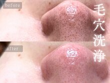 アムールサロン(Amour salon)