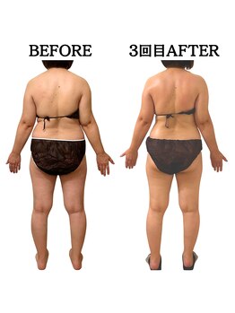 エミニー(EMINY)/