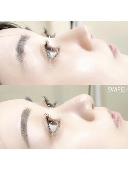 ライラック(lilac)/ラッシュリフト