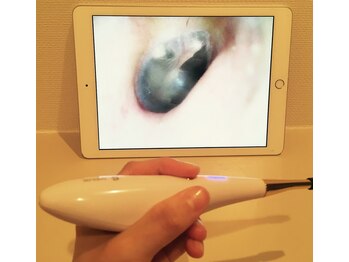 ロータス 日本橋(LOTUS)/イヤーエステ（2）