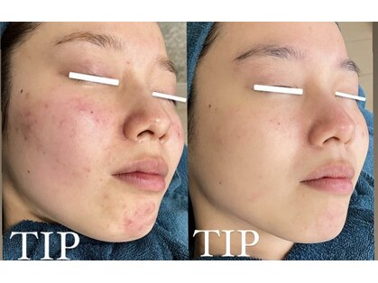 ソランザサロン(Solan the salon)の写真