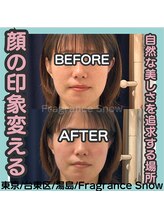 フレグランス スノウ 上野 湯島店(Fragrance Snow)/BeforeAfter4