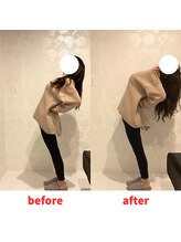 ナオル整体 福岡香椎院(NAORU整体)/30代女性施術事例【腰痛】