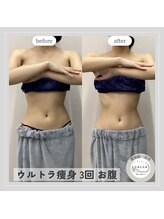 カラー(CALLA)/厚み撃退！スリムなお腹に☆