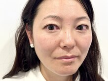 トミー(Tommy)/まつげパーマ