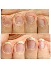 ユキネイル(YUKINAIL)/美爪育成／結果発表