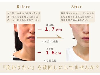 アロハ(ALOHA.)/"変わりたい"後回しにしてない?