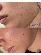 クレア(crea)/お肌【プロセルセラピーズ】金山