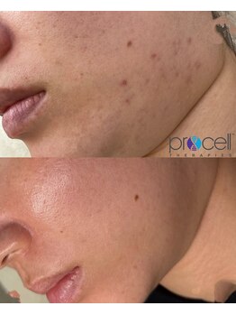 クレア(crea)/お肌【プロセルセラピーズ】金山