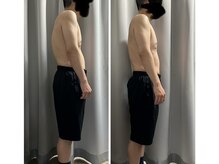 ミロク(369)/1回で猫背、ストレート改善