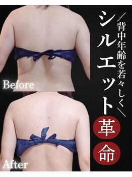 サンティエ(Santie)/