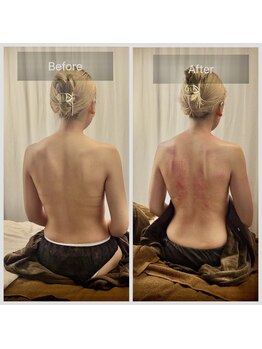 シロ(shiro)/【オイルリンパ×カッサ90分】