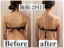 バービーグロウ 恵比寿(Barbie Glow)の雰囲気（肩甲骨剥がし　肩こり改善　美ボディ　ダイエット　ブライダル◎）