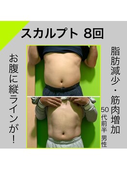 デール(R:DeeL)/週1回のぽっこりお腹ケア