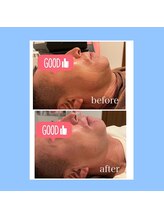 ウナ デ リンゴル 恵比寿店(UNA de Ringol)/メンズOK！メンズ美容もお任せ♪