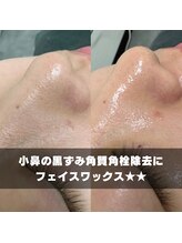 ベレア(BELEA)/小鼻の毛穴、角栓、黒ずみケア♪