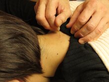 中医鍼灸治療センターの雰囲気（必ず全身をみて、効果の高いツボを見極めます）