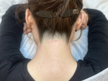 ギューテ(Gute)の写真/【うなじダブル脱毛¥6600】自己処理出来ない箇所はプロにお任せ◎初めてでもトライしやすい☆