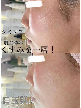 マウム(MAUM)/くすみを一層！白玉肌♪