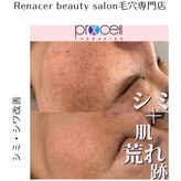 レナセール(Renacer)