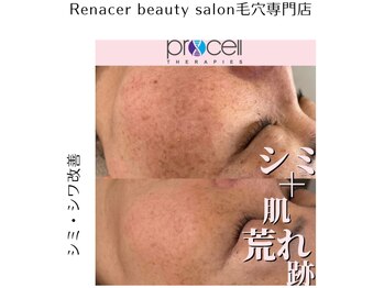 レナセール(Renacer)