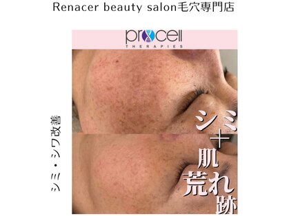 レナセール(Renacer)の写真