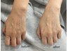 【ULPERMI韓国肌管理】☆３つの層にアプローチ☆肌悩み全般☆14300円→7150円
