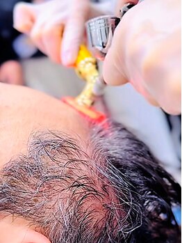 クリスタルグロウ 苫小牧大町店(Crystal Glow)の写真/美しさは、肌と髪の土台から。肌の奥深くにアプローチし、ターンオーバーの正常化や毛根の活性化を促進◎