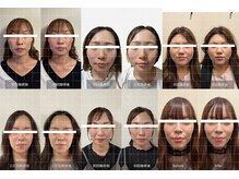 ザ リフト カドモリ 鹿児島 霧島(The Lift KADOMORI)/Before→After