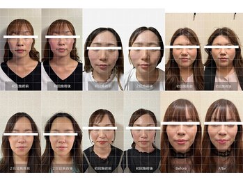 ザ リフト カドモリ 鹿児島 霧島(The Lift KADOMORI)/Before→After