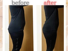 ヨサパーク リリー(YOSA PARK Lily)/