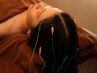 整えて、変えて、美しく◎自律神経×睡眠改善の整美鍼灸60分