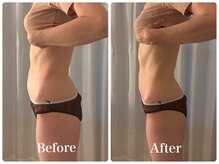 リリー 中目黒(Lily)/【Before→After】60分施術