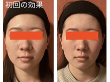 ロイヤリティ(ROYALTY)/魔法のような施術効果☆